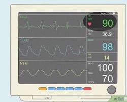 B.Sc Cardiovascular Technology